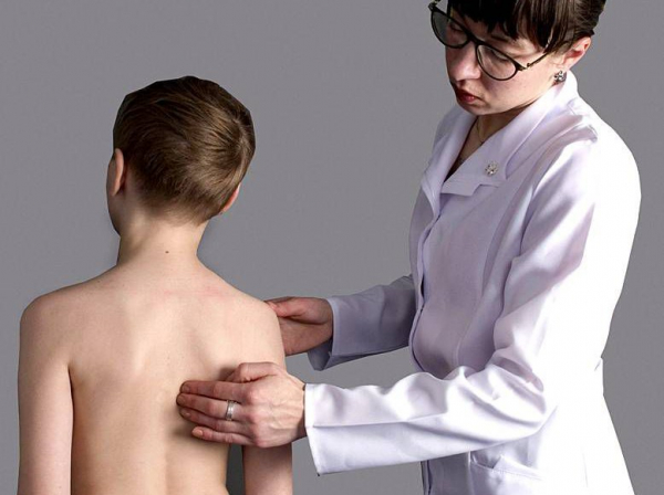 Община Своге с кампания за безплатно скринингово изследване на постурални проблеми в гръбначния стълб при деца